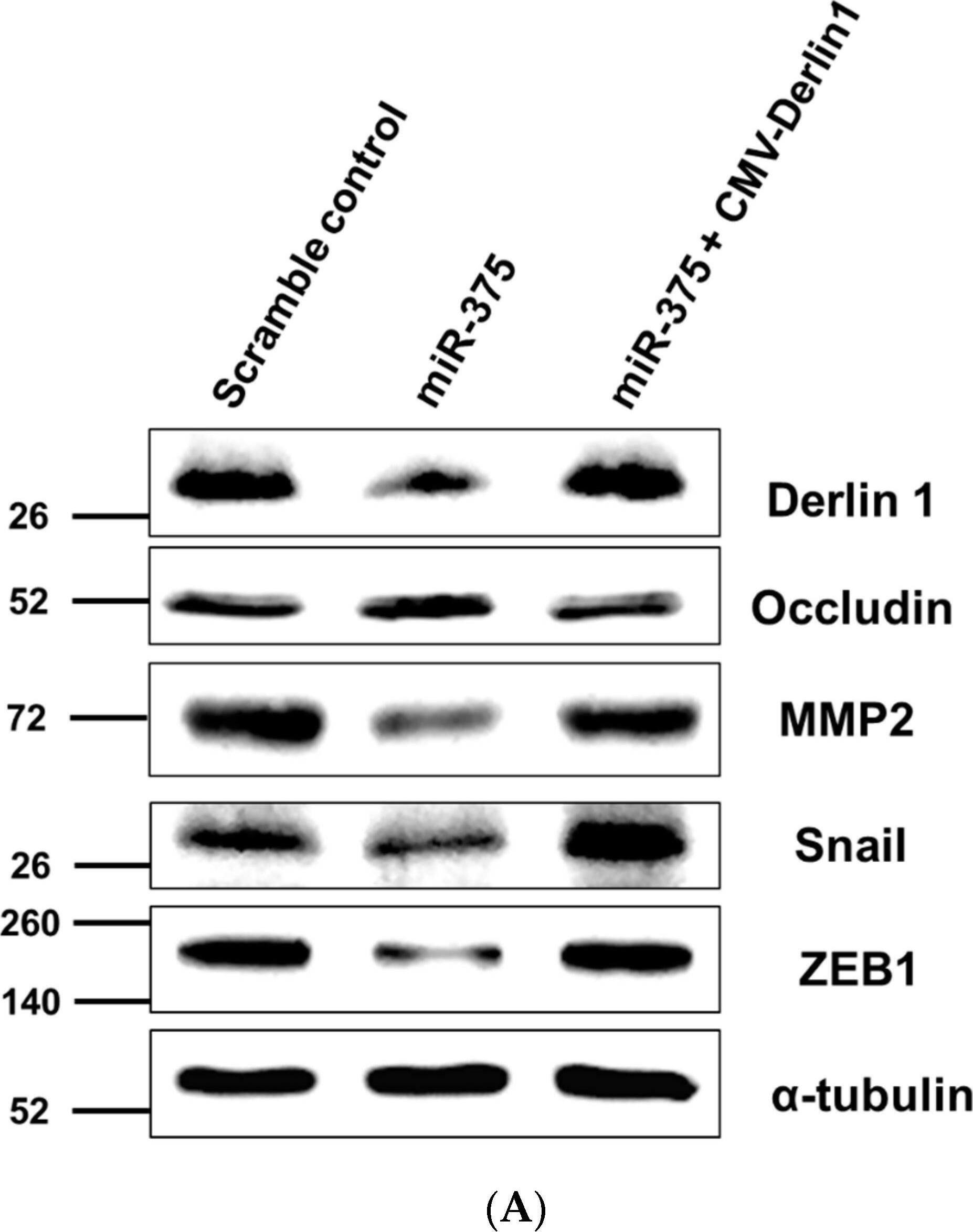 Western Blot: alpha Tubulin Antibody (DM1A) - BSA Free [NB100-690] - MiR-375-3p negatively regulates Derlin-1 & blocks EMT in BFTC909 cells. (A) Western blot revealed the restoration of Derlin-1, MMP-2, Snail, & ZEB1 after co-transfection of miR-375-3p mimics & CMV-Derlin-1 compared with cells transfected with miR-375-3p alone in BFTC909 cells with  alpha -tubulin as a reference (B) Quantification of the protein levels of Derlin-1, occludin, MMP-2, Snail, & ZEB1 from (A) (N = 3). (C) miR-375-3p suppressed BFTC909 cell migration ability but restored by Derlin-1 overexpression (N = 3). (D) miR-375-3p repressed invasion of BFTC909 cells but restored by Derlin-1 overexpression (N = 3). Data were represented as mean ± SD; * p < 0.05, ** p < 0.01. Image collected & cropped by CiteAb from the following publication (//pubmed.ncbi.nlm.nih.gov/35205628), licensed under a CC-BY license. Not internally tested by Novus Biologicals.