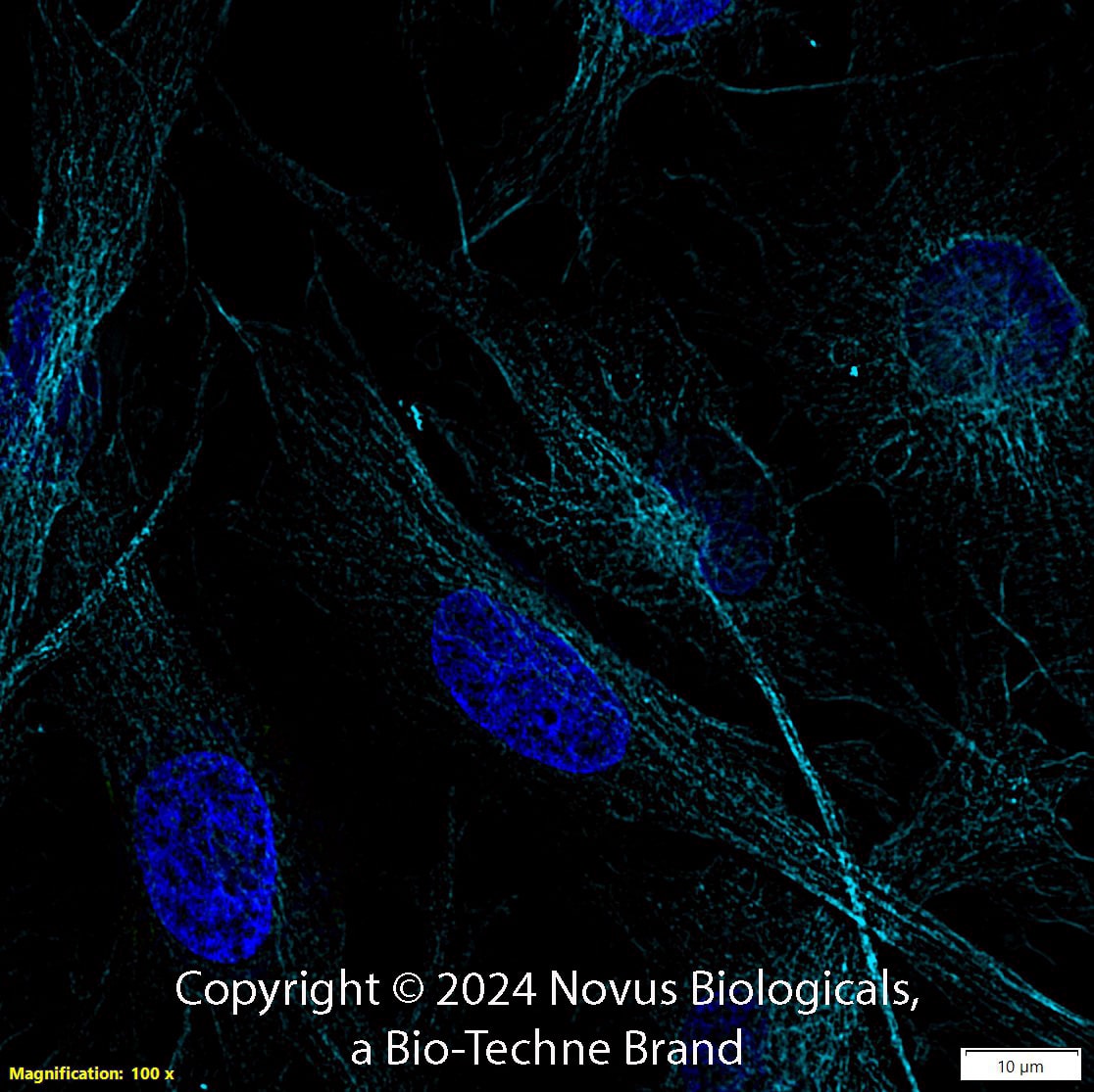 Alpha Tubulin (DM1A) was detected in immersion fixed U-251 MG human glioblastoma cell line using Mouse anti-alpha Tubulin (DM1A) Protein-G purified Monoclonal Antibody conjugated to DyLight 650 (Catalog # NB100-690C) (light blue) at 5 µg/mL overnight at 4C. Cells were counterstained with DAPI (dark blue). Cells were imaged using 100X objective and digitally deconvolved.  