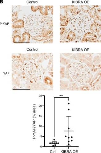 Immunohistochemistry YAP1 Antibody - BSA Free
