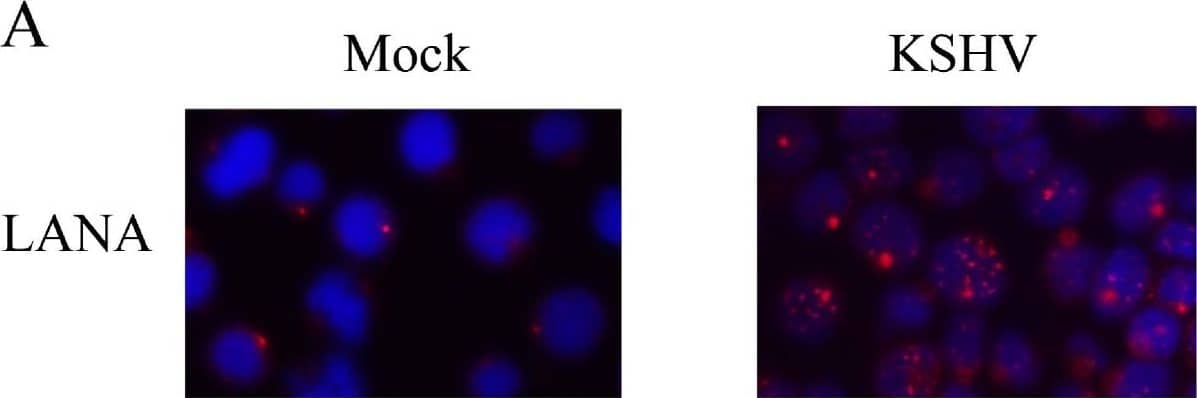 Immunocytochemistry/ Immunofluorescence ORF73/HHV8 Antibody (4C11) - BSA Free