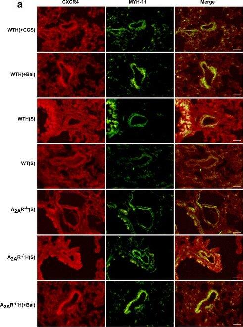 Immunocytochemistry/ Immunofluorescence: CXCR4 Antibody [NB100-74396] - The A2AR & baicalin attenuated CXCR4 expression in the hypoxia-induced PAH mouse model. CXCR4 & MYH11 expression levels in mouse PASMCs were analyzed by immunofluorescence staining (a; n = 3). CXCR4 protein is stained red, & MYH11 is stained green to indicate the PASMCs (×400; scale bars indicate 50 μm). CXCR4 fluorescence intensity was calculated (b; n = 3). CXCR4 protein expression levels in lung tissue were examined by western blot. GAPDH served as an internal control (c, d; n = 3). Data are presented as the mean ± SD. #Value significantly greater than the corresponding value in saline-treated normoxic mice (##P < 0.01). *Value significantly less than the corresponding value in hypoxic mice (*P < 0.05, **P < 0.01). §Value significantly less than the corresponding value in baicalin-treated mice (§P < 0.05, §§P < 0.01). +Value significantly different between WT & A2AR−/− mice (+P < 0.05, ++P < 0.01). WTH, wild-type hypoxic; A2AR−/−H, A2AR−/− hypoxic; s, saline-treated Image collected & cropped by CiteAb from the following publication (//pubmed.ncbi.nlm.nih.gov/28774332), licensed under a CC-BY license. Not internally tested by Novus Biologicals.