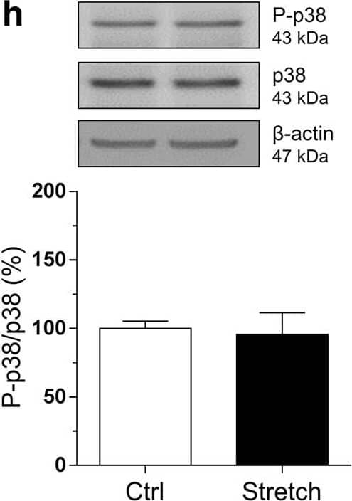 Western Blot: Myelin PLP Antibody [NB100-74503] - Mechanical tensile strain of 30% induces an elongation of paranodal junction & alteration in MAPK signaling in organotypic cerebellar slice culture. a Double immunostaining of organotypic cerebellar slices for CASPR in red & MAG in green. The response was evaluated at time 0 h post-stretch. Altered paranodal junctions are highlighted within white circles in high-magnification images. Scale bar, 50 μm; inset scale bar, 5 μm. b Sketch of CASPR & MAG labeling in the paranodal junction. Quantitative analysis is characterized by three length measurements: c nodal length called (A); d paranodal length called (B); & e (B-A) corresponding to the total length of the CASPR labeling. f–h Proteins were extracted following strain of 30% from control (Ctrl) & stretched (Stretch) slices & western blot was performed for the myelin protein MBP (f), ERK1/2 (g), & p38 (h). The ratio P-ERK on total ERK & the ratio P-p38 on total p38 are presented.  beta -Actin was used as a loading control. Results represent the mean ± SEM (n = 3). ***p < 0.001. CASPR contactin-associated protein, MAG myelin-associated glycoprotein Image collected & cropped by CiteAb from the following publication (//pubmed.ncbi.nlm.nih.gov/30298339), licensed under a CC-BY license. Not internally tested by Novus Biologicals.