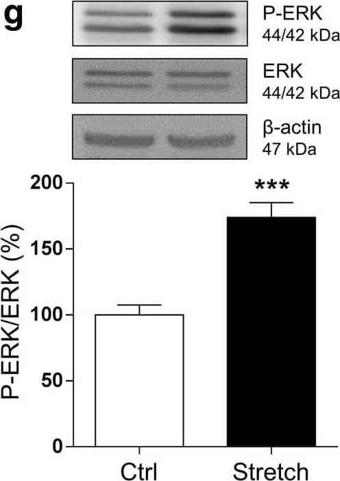 Western Blot: Myelin PLP Antibody [NB100-74503] - Mechanical tensile strain of 30% induces an elongation of paranodal junction & alteration in MAPK signaling in organotypic cerebellar slice culture. a Double immunostaining of organotypic cerebellar slices for CASPR in red & MAG in green. The response was evaluated at time 0 h post-stretch. Altered paranodal junctions are highlighted within white circles in high-magnification images. Scale bar, 50 μm; inset scale bar, 5 μm. b Sketch of CASPR & MAG labeling in the paranodal junction. Quantitative analysis is characterized by three length measurements: c nodal length called (A); d paranodal length called (B); & e (B-A) corresponding to the total length of the CASPR labeling. f–h Proteins were extracted following strain of 30% from control (Ctrl) & stretched (Stretch) slices & western blot was performed for the myelin protein MBP (f), ERK1/2 (g), & p38 (h). The ratio P-ERK on total ERK & the ratio P-p38 on total p38 are presented.  beta -Actin was used as a loading control. Results represent the mean ± SEM (n = 3). ***p < 0.001. CASPR contactin-associated protein, MAG myelin-associated glycoprotein Image collected & cropped by CiteAb from the following publication (//pubmed.ncbi.nlm.nih.gov/30298339), licensed under a CC-BY license. Not internally tested by Novus Biologicals.