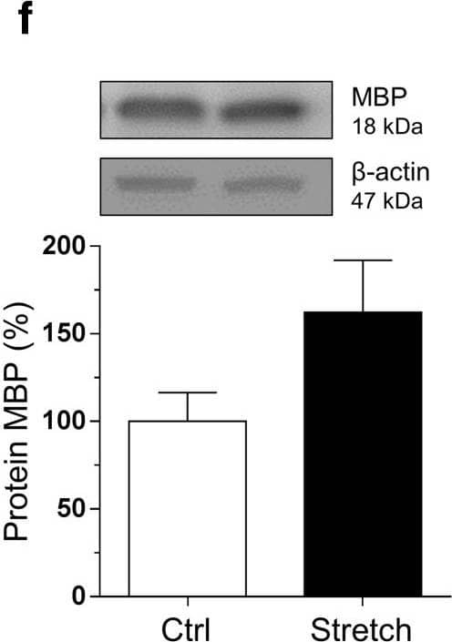 Western Blot: Myelin PLP Antibody [NB100-74503] - Mechanical tensile strain of 30% induces an elongation of paranodal junction & alteration in MAPK signaling in organotypic cerebellar slice culture. a Double immunostaining of organotypic cerebellar slices for CASPR in red & MAG in green. The response was evaluated at time 0 h post-stretch. Altered paranodal junctions are highlighted within white circles in high-magnification images. Scale bar, 50 μm; inset scale bar, 5 μm. b Sketch of CASPR & MAG labeling in the paranodal junction. Quantitative analysis is characterized by three length measurements: c nodal length called (A); d paranodal length called (B); & e (B-A) corresponding to the total length of the CASPR labeling. f–h Proteins were extracted following strain of 30% from control (Ctrl) & stretched (Stretch) slices & western blot was performed for the myelin protein MBP (f), ERK1/2 (g), & p38 (h). The ratio P-ERK on total ERK & the ratio P-p38 on total p38 are presented.  beta -Actin was used as a loading control. Results represent the mean ± SEM (n = 3). ***p < 0.001. CASPR contactin-associated protein, MAG myelin-associated glycoprotein Image collected & cropped by CiteAb from the following publication (//pubmed.ncbi.nlm.nih.gov/30298339), licensed under a CC-BY license. Not internally tested by Novus Biologicals.