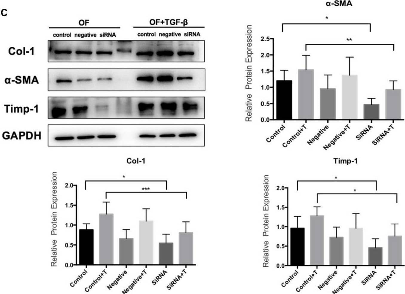 TGF-beta 1 induces the transformation from OF to MFB. (A) Western blot for TGF-beta 1 concentration and time; (B) Src and Acta2 expression in SRC gene knockdown group by q-PCR; and (C) the expression levels of  alpha -SMA, Col-1, and Timp-1 in the SRC gene knockdown group by Western blot. Image collected and cropped by CiteAb from the following open publication (//pubmed.ncbi.nlm.nih.gov/32457885), licensed under a CC-BY license. Not internally tested by Novus Biologicals.