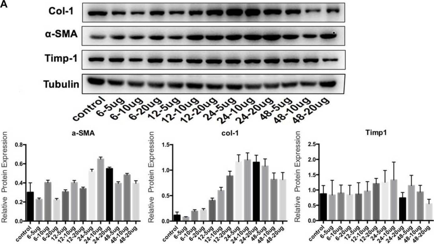 TGF-beta 1 induces the transformation from OF to MFB. (A) Western blot for TGF-beta 1 concentration and time; (B) Src and Acta2 expression in SRC gene knockdown group by q-PCR; and (C) the expression levels of  alpha -SMA, Col-1, and Timp-1 in the SRC gene knockdown group by Western blot. Image collected and cropped by CiteAb from the following open publication (//pubmed.ncbi.nlm.nih.gov/32457885), licensed under a CC-BY license. Not internally tested by Novus Biologicals.