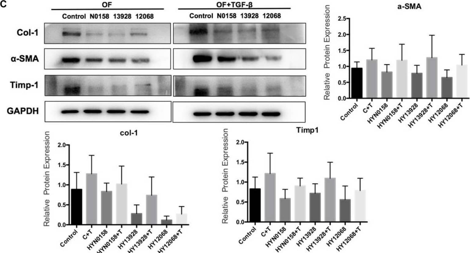 Signaling inhibitors. (A) Acta2 expression after Signaling inhibitors by q-PCR; (B) the expression of Smad3, Nfkb1, Pik3r1, and Akt1 in the SRC gene knockdown group by q-PCR; (C) the expression of  alpha -SMA, Col-1, and Timp-1 after Signaling inhibitors by western blot; (D) the phosphorylation of SMAD2/3, NF-kappa B p65 and PI3K p85 proteins in SRC gene knockdown group by western blot. Image collected and cropped by CiteAb from the following open publication (//pubmed.ncbi.nlm.nih.gov/32457885), licensed under a CC-BY license. Not internally tested by Novus Biologicals.