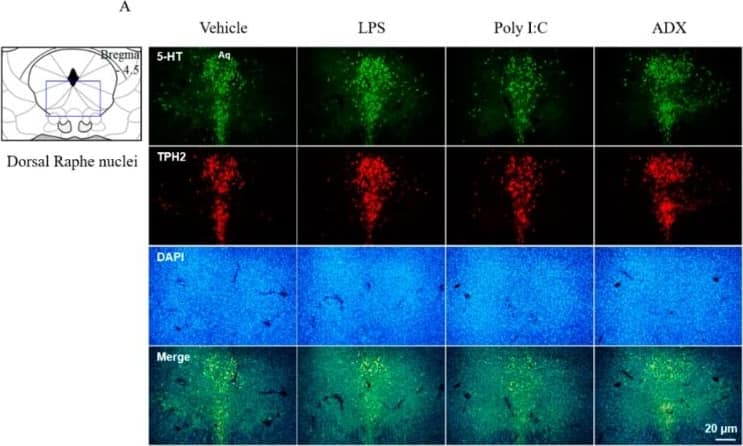 The 5-HT and TPH2 in the raphe nuclei of the brain. The 5-HT- and TPH2-positive double stained cells in the dorsal raphe nuclei (A). Representative photomicrographs were taken at magnifications of 100×. Quantification of 5-HT and TPH2 (B). Data are expressed as the means +/- SD (n = 3). *, p < 0.05; **, p < 0.01 compared with the vehicle group. 5-HT; 5-hydroxytryptamine, TPH2; tryptophan hydroxylase, DAPI; 4′,6-diamidine-2-phenylindole dihydrochloride. Image collected and cropped by CiteAb from the following open publication (//pubmed.ncbi.nlm.nih.gov/31906307), licensed under a CC-BY license. Not internally tested by Novus Biologicals.