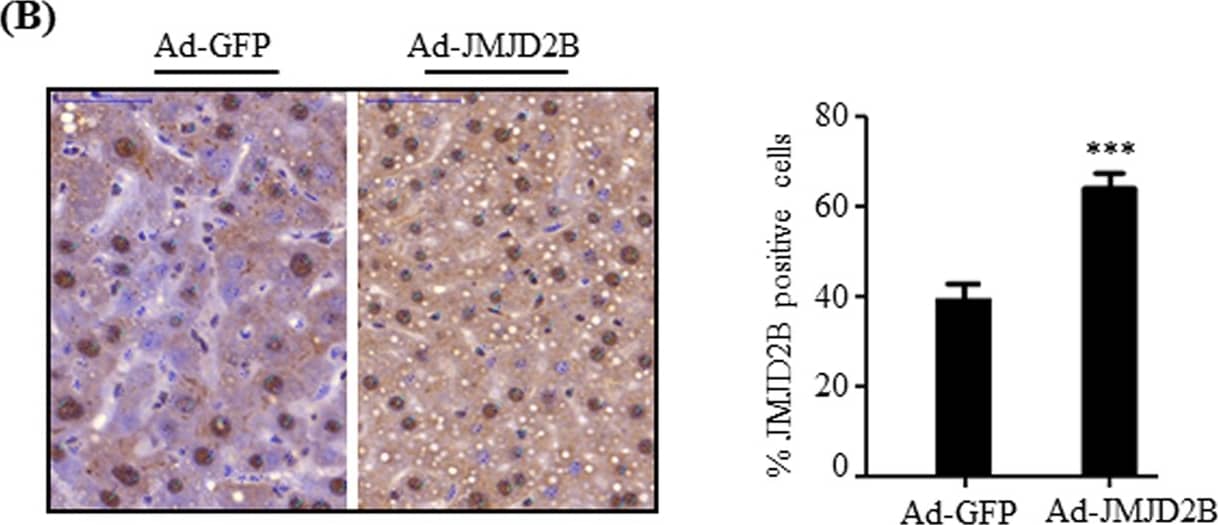 Immunohistochemistry: JMJD2B Antibody [NB100-74605] - Adenovirus-mediated JMJD2B overexpression stimulated hepatic steatosis in vivo. C57BL/6 mice (8 weeks old) were injected with adenovirus Ad-GFP or Ad-JMJD2B. After injection, Ad-injected mice were fed a HFD for 2 weeks. (A) JMJD2B expression was determined by qPCR (B) Immunostaining of JMJD2B (scale bar = 50 μm). Representative photographs are shown. JMJD2B positive cells were counted in ten random areas at 400× magnification & analyzed by using image J. Quantification of immunostaining assay is represented as percentage of JMJD2B positive cells. (C) Hepatic triglyceride (TG) levels were measured by a TG assay kit. (D) Liver morphology, ORO & H&E staining (scale bar = 100 μm). Representative images are presented. (E) Serum total TG levels. (F) Serum total cholesterol levels. Data represent means ± SEM from 5 mice. *p < 0.05 vs. Ad-GFP-infected mice. Image collected & cropped by CiteAb from the following publication (//pubmed.ncbi.nlm.nih.gov/30214048), licensed under a CC-BY license. Not internally tested by Novus Biologicals.