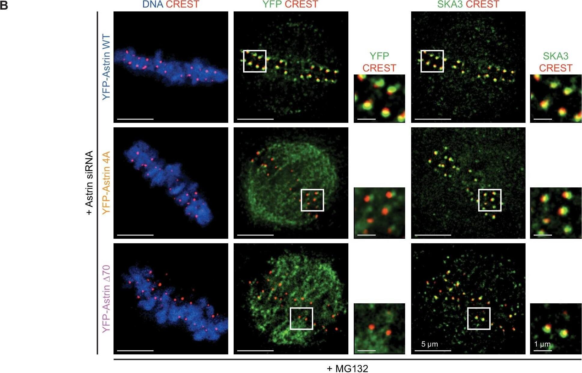 SKA3 localisation is not abrogated due to the lack of Astrin.(A) Representative deconvolved images show SKA3 enrichment at kinetochores of HeLa cells treated with Control or Astrin siRNA. Cells were arrested in metaphase using MG132 for 1 hr prior to fixation and were immunostained with antibodies against Astrin and SKA3 and CREST antiserum (to mark centromeres) and stained with DAPI for DNA. Cropped images show Astrin or SKA3 enrichment at kinetochores. (B) Representative images show SKA3 enrichment at kinetochores of HeLa cells treated with Astrin siRNA before transfection with eukaryotic protein expression vectors encoding YFP-Astrin (WT, 4A or ∆70, as indicated). Cells were arrested in metaphase using MG132 for 1 hr prior to fixation and were immunostained with antibodies against GFP (for detecting YFP-Astrin) and SKA3 and CREST antiserum and co-stained with DAPI for DNA. Cropped images show YFP-Astrin or SKA3 enrichment at kinetochores. Scale as indicated. Image collected and cropped by CiteAb from the following open publication (//pubmed.ncbi.nlm.nih.gov/31808746), licensed under a CC-BY license. Not internally tested by Novus Biologicals.