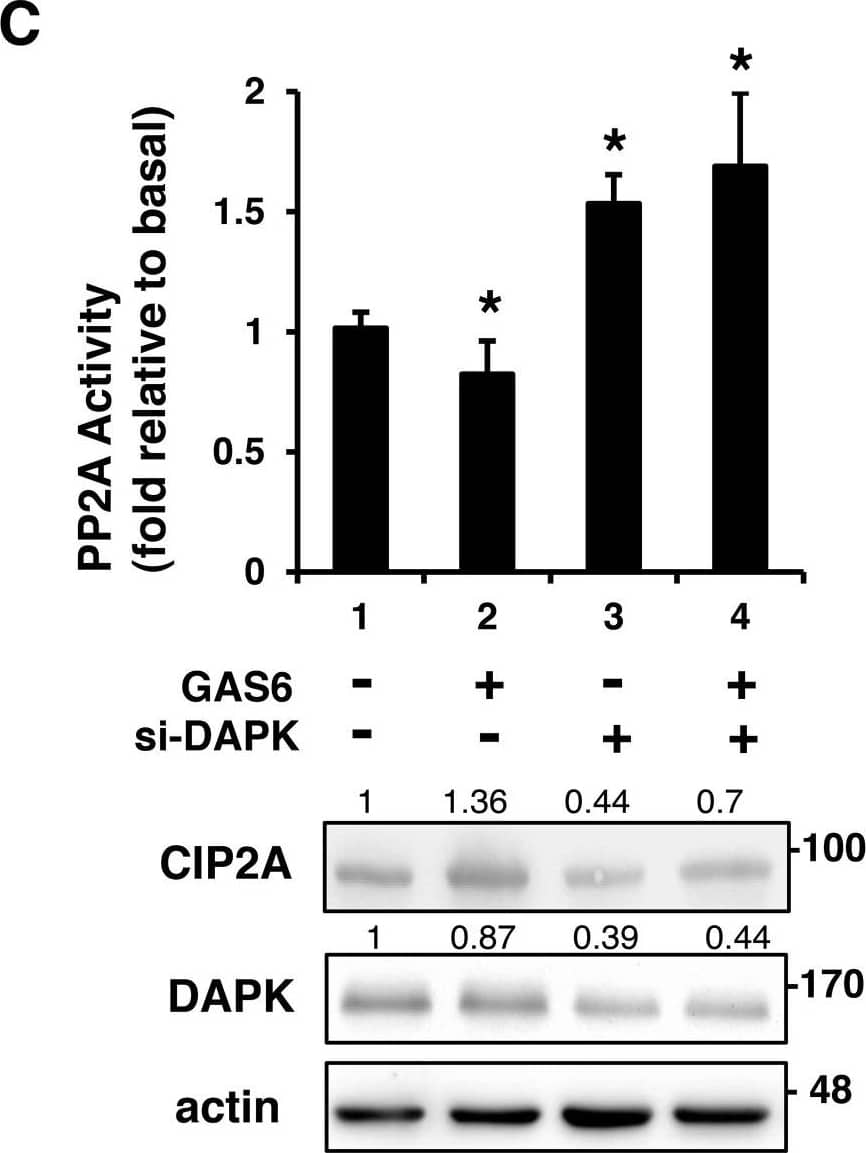 Western Blot: CIP2A Antibody [NB100-74663] - CIP2A is an inhibitor of PP2A-mediated DAPK dephosphorylationRSC96 cells were transfected with control, CIP2A siRNA (A), DKK-CIP2A (B), or DAPK siRNA (C) for 48 h & then exposed to GAS6 (100 ng/ml) for 30 min. PP2A activity & immunoblotting evaluations of DKK, CIP2A, pDAPK, & DAPK were performed. (D) RSC96 cells were incubated with GAS6 (100 ng/ml) for 30 min & co-immunoprecipitation between CIP2A, pDAPK & PP2A was evaluated. Immunoprecipitated PP2A activity was measured. Data are the mean ± SD, & n = 3 for each time point. * p < 0.05, ** p < 0.01, vs. control. Image collected & cropped by CiteAb from the following publication (//www.oncotarget.com/lookup/doi/10.18632/oncotarget.23978), licensed under a CC-BY license. Not internally tested by Novus Biologicals.