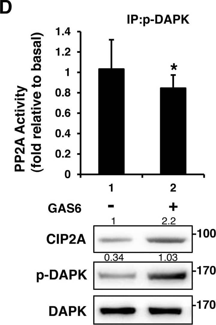 Western Blot: CIP2A Antibody [NB100-74663] - CIP2A is an inhibitor of PP2A-mediated DAPK dephosphorylationRSC96 cells were transfected with control, CIP2A siRNA (A), DKK-CIP2A (B), or DAPK siRNA (C) for 48 h & then exposed to GAS6 (100 ng/ml) for 30 min. PP2A activity & immunoblotting evaluations of DKK, CIP2A, pDAPK, & DAPK were performed. (D) RSC96 cells were incubated with GAS6 (100 ng/ml) for 30 min & co-immunoprecipitation between CIP2A, pDAPK & PP2A was evaluated. Immunoprecipitated PP2A activity was measured. Data are the mean ± SD, & n = 3 for each time point. * p < 0.05, ** p < 0.01, vs. control. Image collected & cropped by CiteAb from the following publication (//www.oncotarget.com/lookup/doi/10.18632/oncotarget.23978), licensed under a CC-BY license. Not internally tested by Novus Biologicals.