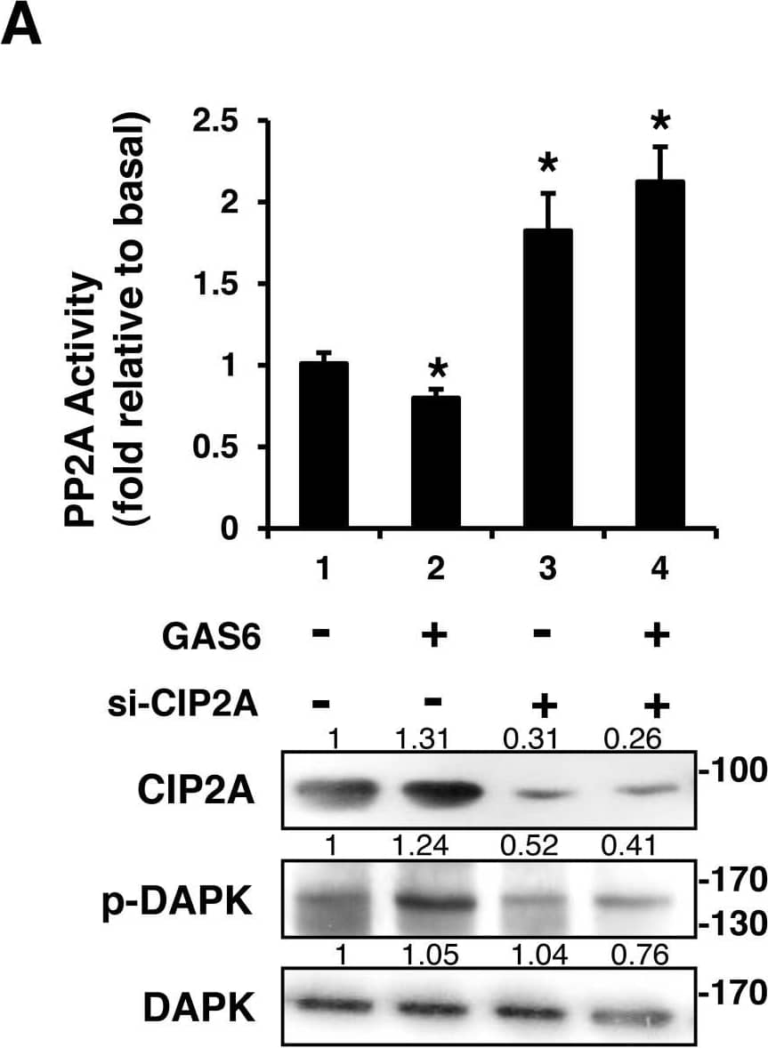 Western Blot: CIP2A Antibody [NB100-74663] - CIP2A is an inhibitor of PP2A-mediated DAPK dephosphorylationRSC96 cells were transfected with control, CIP2A siRNA (A), DKK-CIP2A (B), or DAPK siRNA (C) for 48 h & then exposed to GAS6 (100 ng/ml) for 30 min. PP2A activity & immunoblotting evaluations of DKK, CIP2A, pDAPK, & DAPK were performed. (D) RSC96 cells were incubated with GAS6 (100 ng/ml) for 30 min & co-immunoprecipitation between CIP2A, pDAPK & PP2A was evaluated. Immunoprecipitated PP2A activity was measured. Data are the mean ± SD, & n = 3 for each time point. * p < 0.05, ** p < 0.01, vs. control. Image collected & cropped by CiteAb from the following publication (//www.oncotarget.com/lookup/doi/10.18632/oncotarget.23978), licensed under a CC-BY license. Not internally tested by Novus Biologicals.