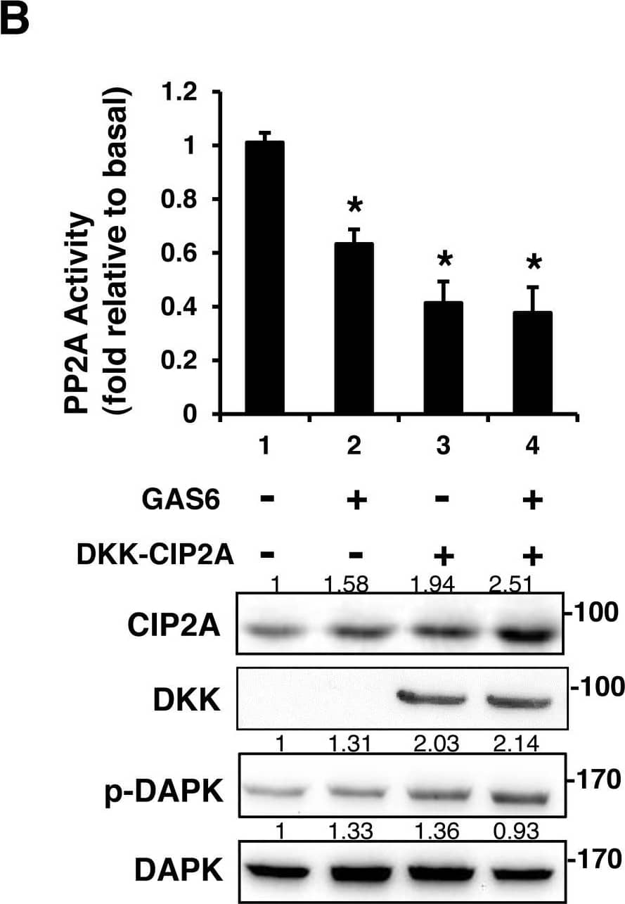 Western Blot: CIP2A Antibody [NB100-74663] - CIP2A is an inhibitor of PP2A-mediated DAPK dephosphorylationRSC96 cells were transfected with control, CIP2A siRNA (A), DKK-CIP2A (B), or DAPK siRNA (C) for 48 h & then exposed to GAS6 (100 ng/ml) for 30 min. PP2A activity & immunoblotting evaluations of DKK, CIP2A, pDAPK, & DAPK were performed. (D) RSC96 cells were incubated with GAS6 (100 ng/ml) for 30 min & co-immunoprecipitation between CIP2A, pDAPK & PP2A was evaluated. Immunoprecipitated PP2A activity was measured. Data are the mean ± SD, & n = 3 for each time point. * p < 0.05, ** p < 0.01, vs. control. Image collected & cropped by CiteAb from the following publication (//www.oncotarget.com/lookup/doi/10.18632/oncotarget.23978), licensed under a CC-BY license. Not internally tested by Novus Biologicals.