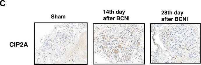 Immunohistochemistry-Paraffin: CIP2A Antibody [NB100-74663] - GAS6 increases the amount of both CIP2A & p-DAPK in RSC96 cells(A) RSC96 cells were incubated with GAS6 (100 ng/ml), & immunoblotting evaluations of CIP2A & p-DAPK expression were performed. The lower panel shows the intensity during basal conditions from the scanned imaged (upper panel). (B) RSC96 cells incubated with & without GAS6 (100 ng/ml) for 30 min & analysed by immunofluorescence. (C) Immunohistochemistry images demonstrated that CIP2A expression levels were higher than sham levels at 14 days & 28 days in the cavernous nerve after BCNI. Image collected & cropped by CiteAb from the following publication (//www.oncotarget.com/lookup/doi/10.18632/oncotarget.23978), licensed under a CC-BY license. Not internally tested by Novus Biologicals.