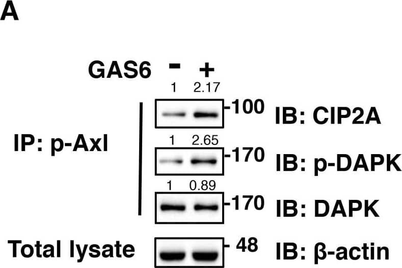 Western Blot: CIP2A Antibody [NB100-74663] - GAS6 triggers p-Axl, p-DAPK & CIP2A to form a protein complex in RSC96 cells(A-B) Co-immunoprecipitation between p-Axl, p-DAPK & CIP2A with GAS6 stimulation for 30 min in RSC96 cells. Total lysate indicates 1/10 input in each experiment. The relative quantification of protein expression was normalized with respect to  beta -actin expression. (C) Immunofluorescence image demonstrating co-localized CIP2A & p-Axl & co-localized p-Axl & p-DAPK (D) after GAS6 stimulation for 30 min in RSC96 cells. Image collected & cropped by CiteAb from the following publication (//www.oncotarget.com/lookup/doi/10.18632/oncotarget.23978), licensed under a CC-BY license. Not internally tested by Novus Biologicals.