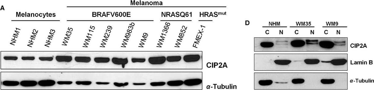 Western Blot: CIP2A Antibody [NB100-74663] - Characterization of CIP2A expression in a panel of normal human melanocytes (NHM) & melanoma cell lines. (A) Immunoblot analysis & (B) quantification of protein expression levels of CIP2A (C) CIP2A mRNA expression measured by qRT-PCR. NHM1 line was used as calibrator. (D) Cytoplasmic & nuclear expression of CIP2A in normal melanocytes, primary & metastatic melanoma cell lines assessed by immunoblot analysis & (E) by immunohistochemical staining. CIP2A, cancerous inhibitor of protein phosphatase 2A. Image collected & cropped by CiteAb from the following publication (//pubmed.ncbi.nlm.nih.gov/25663244), licensed under a CC-BY license. Not internally tested by Novus Biologicals.