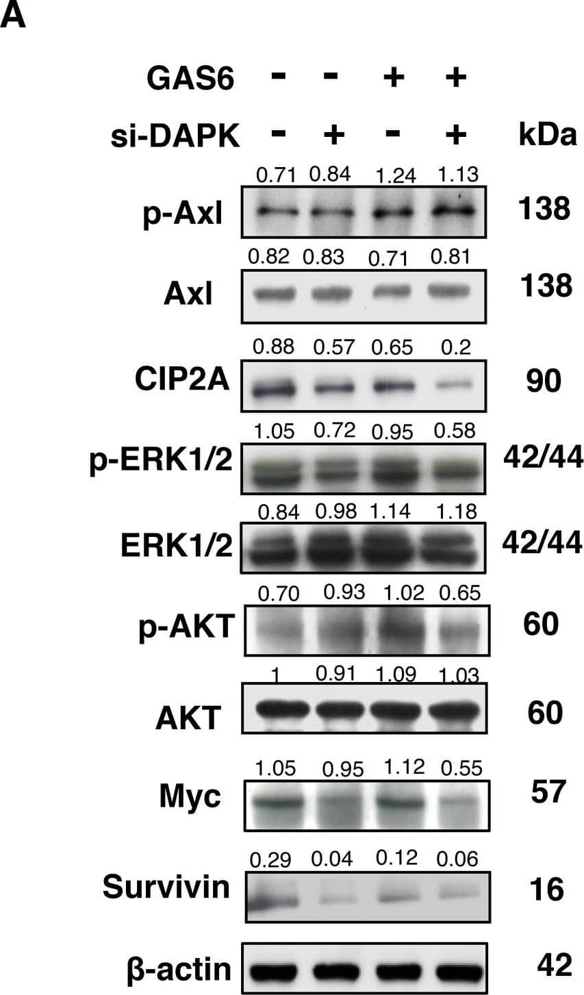 Western Blot: CIP2A Antibody [NB100-74663] - GAS6 triggered Schwann cell proliferation primarily through CIP2A & DAPK(A) RSC96 cells were transfected with either control or DAPK siRNA for 48 h & then exposed to GAS6 (100 ng/ml) for 30 min. Immunoblotting evaluations of pAxl, Axl, CIP2A, DAPK, pERK1/2, ERK1/2, pAKT, AKT, Myc & Survivin. (B) RSC96 cells were transfected with either control or CIP2A siRNA for 48 h & then exposed to GAS6 (100 ng/ml) for 30 min. Immunoblotting evaluations of pAxl, Axl, DAPK, pDAPK, pERK1/2, ERK1/2, pAKT, AKT, Myc & Survivin. (C) DAPK or CIP2A was knocked down for 48 h then RSC96 cells were incubated with GAS6 (100 ng/ml) at the indicated hours. Cell viability was analysed via the WST-1 assay. Data are the mean ± SD, & n = 3 for each time point. * p < 0.05, ** p < 0.01 vs. scramble. Image collected & cropped by CiteAb from the following publication (//www.oncotarget.com/lookup/doi/10.18632/oncotarget.23978), licensed under a CC-BY license. Not internally tested by Novus Biologicals.