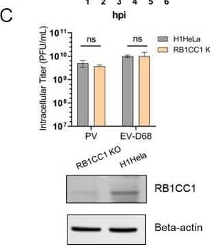 Western Blot RB1CC1 Antibody
