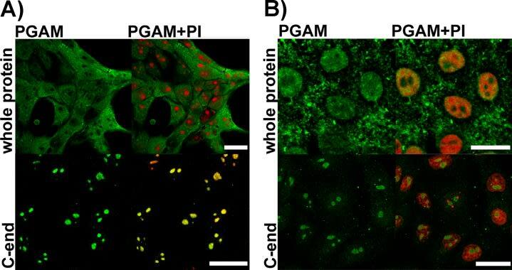 Immunocytochemistry/ Immunofluorescence: PGAM1/2/4 Antibody [NB100-774] - Detection of PGAM in KLN-205 cells with antibodies directed to whole PGAM protein or to C-terminal peptide of PGAMA. control conditions (scan parameters in red channel were set to emphasize nucleolar staining with propidium iodide – PI) B. RNase-treated cells. Bar=15 μm. Image collected & cropped by CiteAb from the following publication (//www.oncotarget.com/lookup/doi/10.18632/oncotarget.4044), licensed under a CC-BY license. Not internally tested by Novus Biologicals.