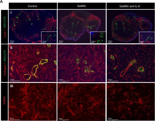 Immunocytochemistry/ Immunofluorescence: Peripheral Node Addressin Antibody (MECA-79) - Non-Recombinant Monoclonal [NB100-77673] - Local release of anti-IL-6 from IMB suppresses LN fibrosis. The skin allografts were harvested at 7 days post-transplantation. (A-i) Lymphatic vessel expansion (Lyve-1+) & HEV elongation (MECA79+) were similar between all groups. (A-ii,iii) Dense staining of collagen I & PDPN was seen in DLNs harvested from control & GelMA group compared to those from GelMA/anti-IL-6 group. (representative images from 4 different mice per group). Image collected & cropped by CiteAb from the following publication (//pubmed.ncbi.nlm.nih.gov/31024011), licensed under a CC-BY license. Not internally tested by Novus Biologicals.