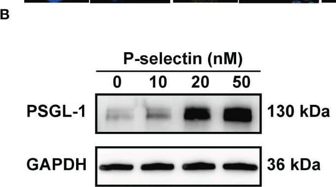 High level of P-selectin leads to increased PSGL-1 expression and NETs formation in human neutrophils. Human peripheral blood neutrophils were isolated and treated with P-selectin recombinant protein at concentrations of 10, 20 and 50 nM. (A) Representative images of neutrophil stained with PSGL-1 (yellow) and DAPI (blue). The inset box from each group is magnified. Scale bar: 5 μm and 20 μm, respectively. (B) Cell lysates were collected and subjected to Western blot analysis for PSGL-1. GAPDH was used as a loading control. Data from one representative experiment are shown. (C) Relative intensities of PSGL-1 against GAPDH. (n=3, **P < 0.01) (D) Representative images of neutrophils stained with MPO (red), CitH3 (Green) and DAPI (blue). The inset box from each group is magnified. Scale bar: 50 μm and 20 μm, respectively. The arrows indicate NETs. (E) NET-forming cells per field are quantified. (n=6, ****P < 0.0001) The neutrophil supernatants were assessed for cf-DNA (F) and MPO-DNA complexes (G). (n=3, *P < 0.05, **P < 0.01, ***P < 0.001). Image collected and cropped by CiteAb from the following open publication (//pubmed.ncbi.nlm.nih.gov/37841279), licensed under a CC-BY license. Not internally tested by Novus Biologicals.
