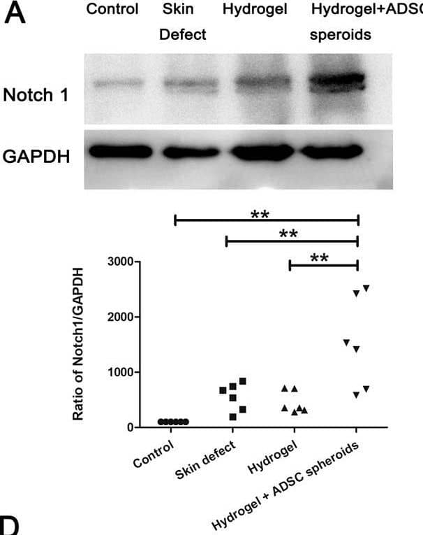 The DA-MeHA hydrogel regulated Notch signaling.A–E DA-MeHA hydrogel-encapsulated spheroids or suspensions of ADSCs upregulated the expression of Notch1 and Notch2 while downregulating the expression of Notch3, Jagged1 and Jagged2. F No significant difference in Hes1 expression was observed among the groups. n = 4 samples/group (*p < 0.05 and **p < 0.01). Image collected and cropped by CiteAb from the following open publication (//pubmed.ncbi.nlm.nih.gov/36030275), licensed under a CC-BY license. Not internally tested by Novus Biologicals.