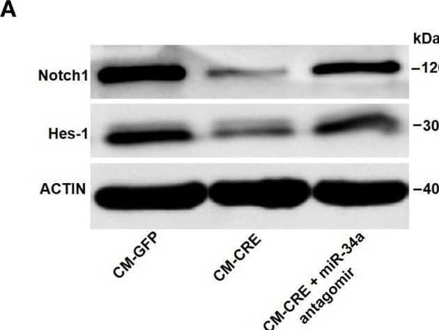 Interleukin-33 (IL-33) decreases bone marrow-derived monocytes (BMMs) osteoclastogenesis by inhibiting Notch1 activity. (A) Western blot analysis of Notch1 and Hes-1 expression in osteoclast progenitors incubated with CM-CRE in the presence of miR-34a-5p antagomir. (B–D) Quantification of Notch1, Jag1, and Hes-1 expression in osteoclast progenitors incubated with CM-CRE in the presence of miR-34a-5p antagomir. (E) Western blot analysis of Notch1 and Hes-1 expression in osteoclast progenitors induced by IL-33 in the presence of miR-34a-5p antagomir. (F–H) Quantification of Notch1, Jag1, and Hes-1 expression in osteoclast progenitors treated with IL-33 in the presence of miR-34a-5p antagomir. (I–K) BMMs osteoclastic formation and tartrate-resistant acid phosphatase (TRAP) activity assay after treatment with 20 ng/ml IL-33 in the presence of Jag-1. Red arrows indicated multinucleated osteoclasts. Scale bars represent 100 um. (L–O) Quantification of Trap, Cathepsin K, Nfatc1, and C-fos expression in osteoclast progenitors treated with 20 ng/ml IL-33 in the presence of Jag-1. *P < 0.05, **P < 0.01, ***P < 0.001. P values were analyzed by one-way ANOVA. Image collected and cropped by CiteAb from the following open publication (//pubmed.ncbi.nlm.nih.gov/29085370), licensed under a CC-BY license. Not internally tested by Novus Biologicals.