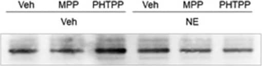 Western Blot: alpha-1A Adrenergic R/ADRA1A Antibody [NB100-78585] - Effects of MPP Versus PHTPP on NE Regulation of VMN Nitrergic & GABA Neuron Adrenergic Receptor Protein Expression. Pooled lysates of laser-microdissected VMN nNOS- or GAD-immunopositive neurons from groups of female rats pretreated with V versus ER alpha  or -beta  antagonist prior to intra-VMN V or NE infusion were analyzed by Western blot for alpha1- ( alpha 1-), alpha2- ( alpha 2-), or beta1- ( beta 1-) AR protein expression. Nitrergic neuron  alpha 1-, F(5, 12) = 10.51, p = .0005;  alpha 2-, F(5, 12) = 16.50, p < .0001; &  beta 1-, F(5, 12) = 11.72, p = .0003 protein profiles are depicted in Panels 3A to C; GABAergic neuron  alpha 1-, F(5, 12) = 5.52, p = .007;  alpha 2-, F(5, 12) = 10.47, p < .0001; &  beta 1-, F(5, 12) = 12.21, p = .0002 protein profiles are presented in Panels 3D to F. Data show mean normalized protein O.D. measures ± SEM for the following treatment groups: Veh/Veh (solid white bars, n = 6), MPP/Veh (diagonal-striped white bars, n = 6), PHTPP/Veh (cross-hatched white bars, n = 6), Veh/NE (solid gray bars, n = 6), MPP/NE (diagonal-striped gray bars, n = 6), & PHTPP/NE (cross-hatched gray bars, n = 6). *p < .05; **p < .01; ***p < .001.  alpha 1-AR = alpha1 adrenergic receptor;  alpha 2-AR = alpha2 adrenergic receptor;  beta 1-AR = beta1 adrenergic receptor; MPP = 1,3-Bis(4-hydroxyphenyl)-4-methyl-5-[4-(2-piperidinylethoxy)phenol]-1H-pyrazole dihydrochloride; PHTPP = 4-[2-phenyl-5,7-bis(trifluoromethyl)pyrazolo[1,5-a]pyrimidin-3-yl]phenol; NE = norepinephrine. Image collected & cropped by CiteAb from the following publication (//pubmed.ncbi.nlm.nih.gov/32233668), licensed under a CC-BY license. Not internally tested by Novus Biologicals.