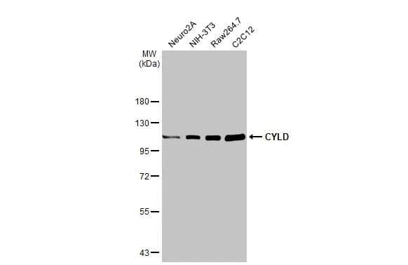 Various whole cell extracts (30 ug) were separated by 7.5% SDS-PAGE, and the membrane was blotted with CYLD antibody (NB100-78600) diluted at 1:1000. The HRP-conjugated anti-rabbit IgG antibody was used to detect the primary antibody. 