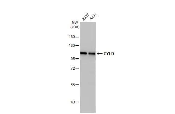 Various whole cell extracts (30 ug) were separated by 7.5% SDS-PAGE, and the membrane was blotted with CYLD antibody (NB100-78600) diluted at 1:1000. The HRP-conjugated anti-rabbit IgG antibody was used to detect the primary antibody. 