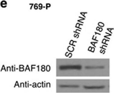 BAF180 knockdown in BAF180-expressing H2 ccRCC cell lines reduces cell survival/proliferation. (a, c, e) Western blot analyses of BAF180 protein in 786-O (a), KC-12 (c) and 769-P (e) H2 ccRCC cells targeted with non-targeting scramble (SCR) shRNA or BAF180 shRNA. (b, d, f) Quantification and photos of the clonogenic survival assay for 786-O (b), KC-12 (d) and 769-P (f) cells targeted with control scr-shRNA or BAF180 shRNA. (g) The location of BAF180 sgRNA #1 and #2 relative to the BAF180-coding region are shown (upper). The diagram (lower) shows the type and frequency of mutations in the BAF180 gene, found in ccRCC tumors, adapted from the article by Valera et al.7 (h) DNA sequence and sequencing profiles of parental BAF180 DNA (parental) and BAF180 DNA after targeted by BAF180 sgRNA #1 (left) and #2 (right). The blue lines indicate the target sequences of sgRNAs and the red lines showing the protospacer adjacent motif sequence. The black arrows indicate the positions that double-strand DNA cleavages are expected to occur by the sgRNA-led Cas9 enzyme. The red boxes are to indicate the nucleotides that have been deleted by CRISPR–Cas9 system. SgRNA #2 Clone #1 shows a mixed sequence after the cleavage site, probably due to the fact that the deletion in the BAF180 allele 1 is different from the deletion in BAF180 allele 2. (i) Western blot analysis of BAF180 protein in 786-O/Cas9 cells expressing no sgRNA, or PBRM1 sgRNA #1 (clone #1) or #2 (clone #1). (j) Quantification and photos of the clonogenic survival assay for 786-O/Tet-on Cas9 clones without sgRNA expression, or with expression of BAF180 sgRNA #1 (clone #1) or #2 (clone #1). Image collected and cropped by CiteAb from the following open publication (//pubmed.ncbi.nlm.nih.gov/28092369), licensed under a CC-BY license. Not internally tested by Novus Biologicals.