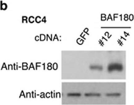 Re-expression of BAF180 in H1H2 ccRCC lines of RCC4 and SLR25 reduces cell survival/proliferation. (a) Western blot analysis of BAF180 protein in ccRCC cell lines. Beta actin serves as a protein-loading control for this and other WB analysis in the paper. (b) Western blot analysis of BAF180 protein in RCC4 cell clones stably transfected with a BAF180 expression vector or a vector-expressing GFP. (c) Quantification and photos of clonogenic survival assays for RCC4/BAF180 or GFP cells. Quantification was performed using MetaMorph software to measure the total area covered by colonies. (d) Western blot analysis of BAF180 protein expression in SLR25/Tet-on BAF180 cell line with (+) or without (−) doxycycline treatment. (e) Quantification and photos of clonogenic survival assay for SLR25/Tet-on BAF180 cells in the presence (+) or absence (−) of doxcycline. Image collected and cropped by CiteAb from the following open publication (//pubmed.ncbi.nlm.nih.gov/28092369), licensed under a CC-BY license. Not internally tested by Novus Biologicals.