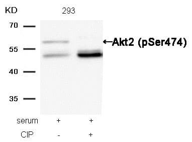 Western Blot: AKT2 [p Ser474] Antibody [NB100-81780] - Analysis of extracts from 293 cells, treated with serum or calf intestinal phosphatase (CIP), using NB100-81780.