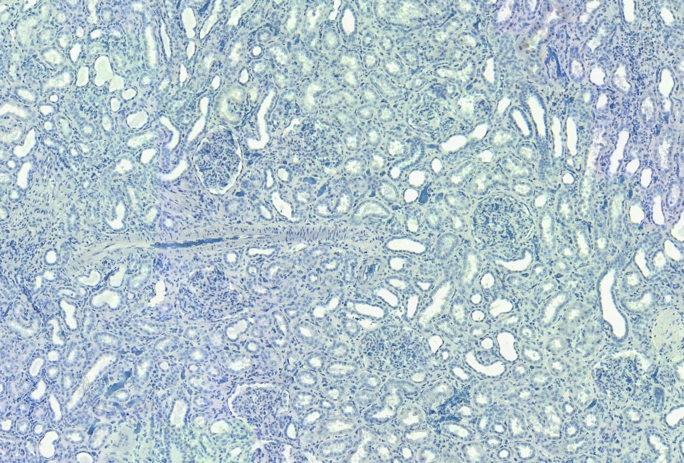 Immunohistochemistry-Paraffin: SET Antibody [NB100-817] - Negative Control showing staining of paraffin embedded Human Kidney, with no primary antibody.