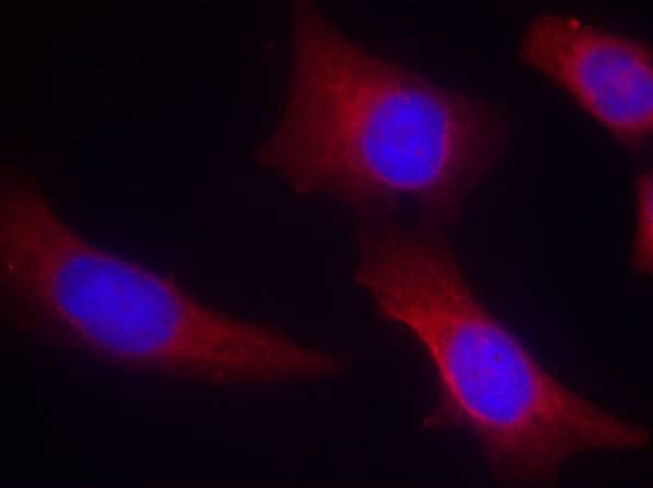 Immunohistochemistry-Paraffin: CaM Kinase II alpha Antibody - BSA Free [NB100-81830] - Immunofluorescence staining of paraffin-embedded human hippocampal region tissue from the falling sickness disease using NB100-81830. 