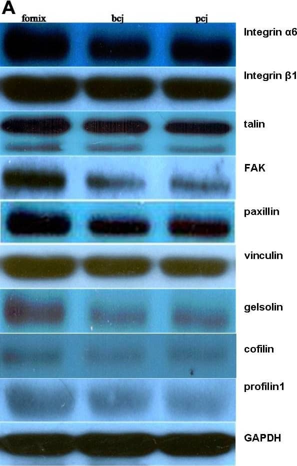 Western blot analysis. GAPDH was used as the loading control. A: The proteins identities are indicated on the right. B: Band intensity was quantified by densitometry and the fold difference of each microfilament regulator in the conjunctival bulbar and palpebral epithelia compared to the conjunctival forniceal epithelia was expressed graphically. bcj, bulbar conjunctiva; pcj, palpebral conjunctiva. Image collected and cropped by CiteAb from the following open publication (//pubmed.ncbi.nlm.nih.gov/21151337), licensed under a CC-BY license. Not internally tested by Novus Biologicals.