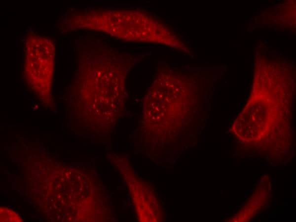Immunocytochemistry/Immunofluorescence: FOXO3 [p Ser253] Antibody [NB100-81929] - Staining of methanol-fixed HeLa cells using NB100-81929 (red).
