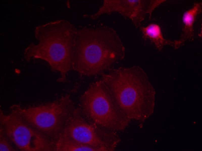 Immunocytochemistry/Immunofluorescence: ErbB2/Her2 [p Tyr877] Antibody [NB100-81961] - Staining of methanol-fixed MCF7 cells using NB100-81961