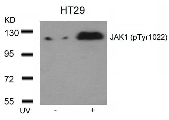 Western Blot: Jak1 [p Tyr1022] Antibody [NB100-82005] - Analysis of extracts from HT29 cells untreated or treated with UV using NB100-82005.