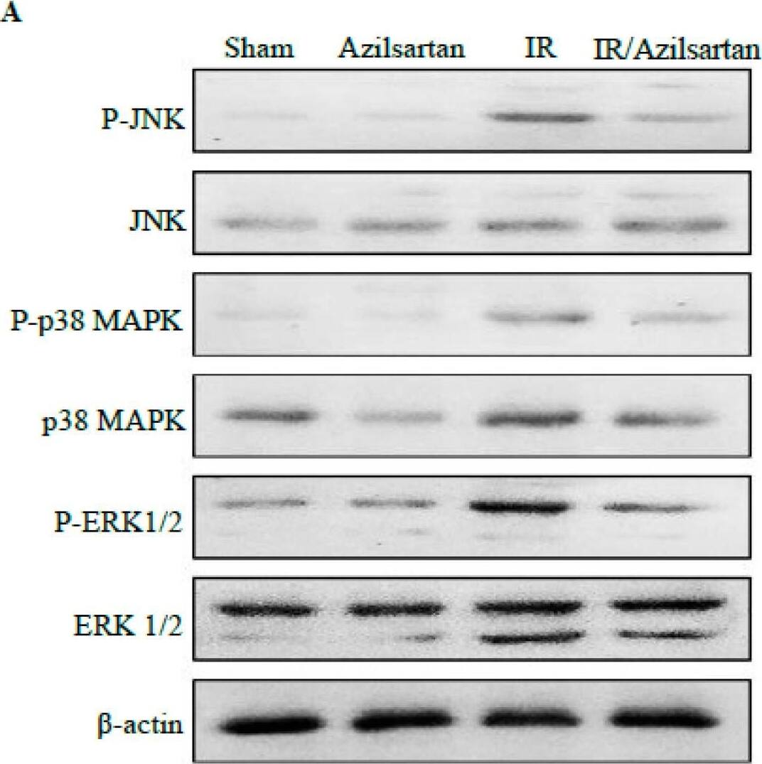 Effect of azilsartan on the expression of p38 MAPK, ERK1/2, and JNK proteins. (A) Representative Western blots of phosphorylated and total p38 MAPK, ERK1/2, JNK, and  beta -actin proteins for different groups. (B) Expressions of phosphorylated/total ratio of proteins were densitometrically expressed as fold change, using bands in (A), relative to that of sham control rats, after normalization to the corresponding  beta -actin. Bars represent mean +/- SD. Followed by post hoc Dunnett test, significant difference was analyzed by two-way ANOVA test, where ***; p < 0.001, compared to the sham group, and ### p < 0.001, compared to the IR group. p38 MAPK; Mitogen Activated Protein Kinase, ERK1/2; extracellular signal-regulated protein kinase, c-JNK; Jun N terminal kinase, SD; standard deviation, IR; ischemia reperfusion. Image collected and cropped by CiteAb from the following open publication (//www.mdpi.com/2073-4409/12/1/185), licensed under a CC-BY license. Not internally tested by Novus Biologicals.