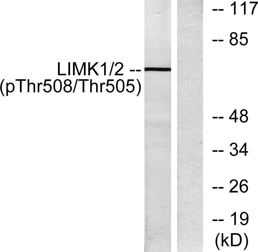 Western Blot: LIM Kinase 1 [p Thr508] Antibody [NB100-82021] - Western blot analysis of lysates from COLO205 cells, using NB100-82021. The lane on the right is blocked with the phospho peptide. 