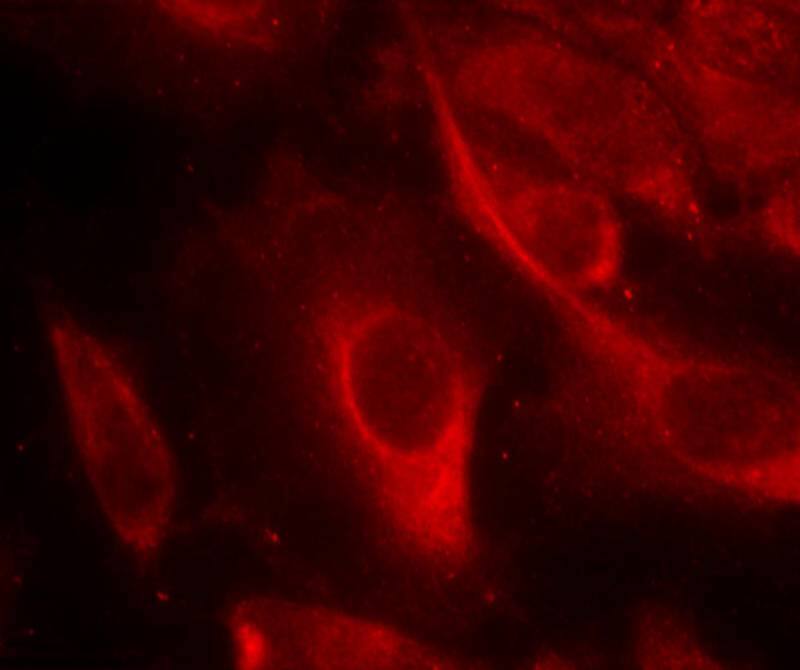 Immunocytochemistry/Immunofluorescence: MKK6/MEK6 [p Ser207] Antibody [NB100-82050] - Staining of methanol-fixed Hela cells showing cytoplasmic staining using NB100-82050