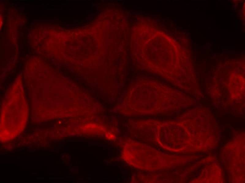 Immunocytochemistry/Immunofluorescence: p70 S6 Kinase/S6K [p Ser411] Antibody [NB100-82120] - Staining of methanol-fixed MCF7 cells using NB100-82120.
