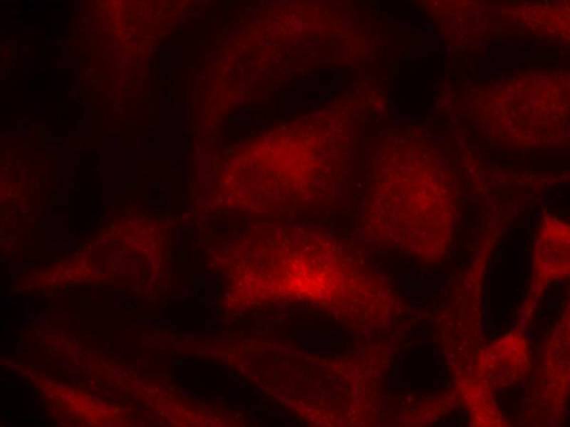 Immunocytochemistry/ Immunofluorescence: Rac1 Antibody - BSA Free [NB100-82169] - Immunofluorescence staining of methanol-fixed Hela cells using NB100-82169. 