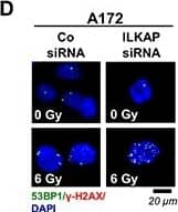 Immunocytochemistry/ Immunofluorescence 53BP1 Antibody - BSA Free
