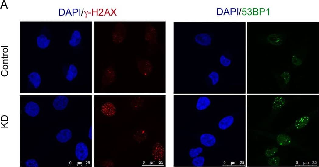 Immunocytochemistry/ Immunofluorescence 53BP1 Antibody - BSA Free