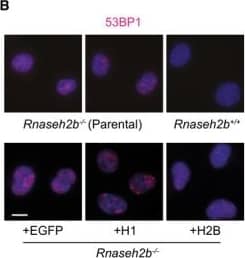 Immunocytochemistry/ Immunofluorescence 53BP1 Antibody - BSA Free
