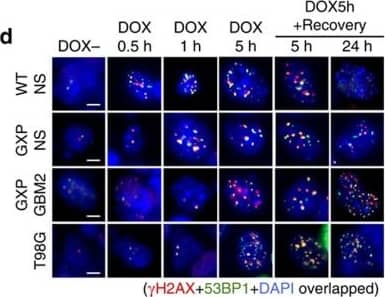 Immunocytochemistry/ Immunofluorescence 53BP1 Antibody - BSA Free