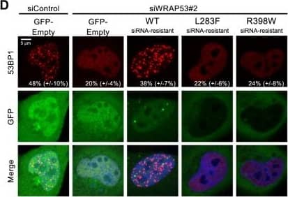 Immunocytochemistry/ Immunofluorescence 53BP1 Antibody - BSA Free